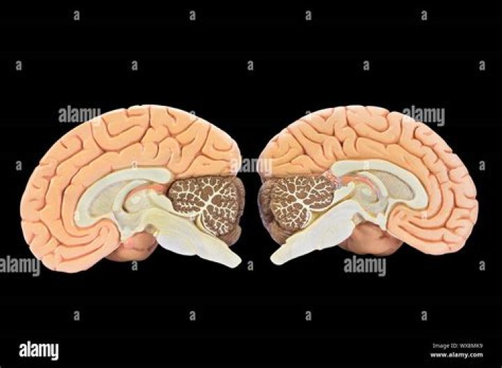 Why is the brain divided into two halves?