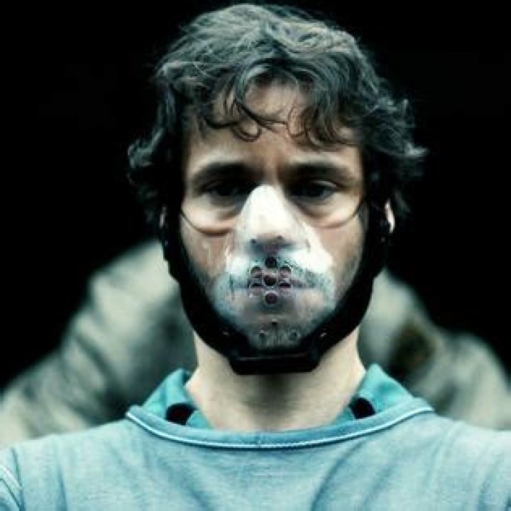 Will graham face disfigured?