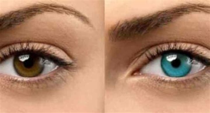 Will honey change your eye color?
