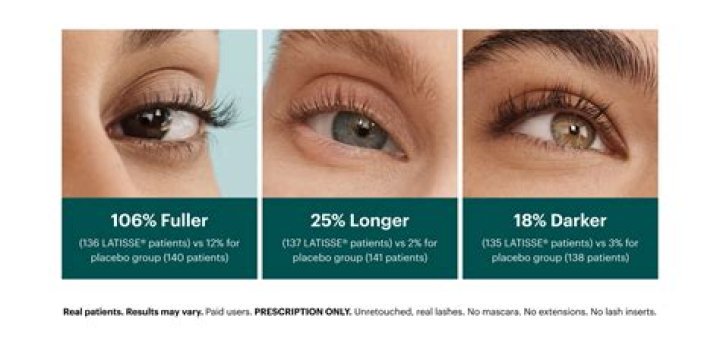 Will latisse change eye color?