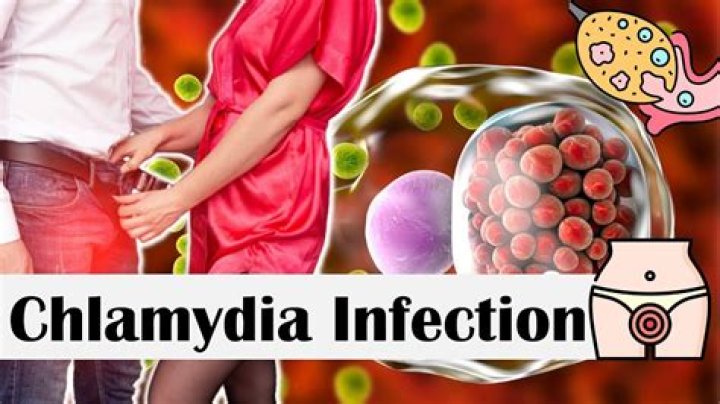 Would chlamydia go away on its own?